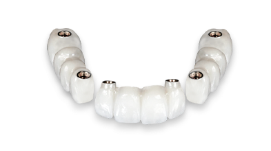 cost of Bicon short dental implants in Mexico