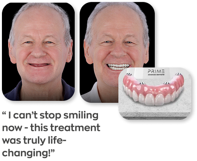 Man smiling with the quote: I can't stop smiling now, this treatment was truly life-changing!