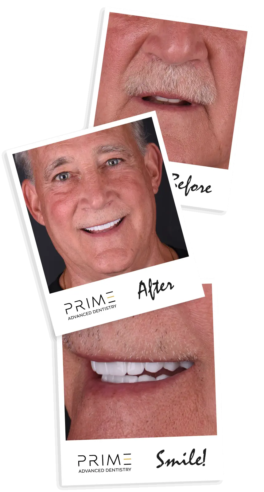 Smile Gallery Prime Advanced Dentistry: Image gallery showcasing smiles transformed at Prime Advanced Dentistry