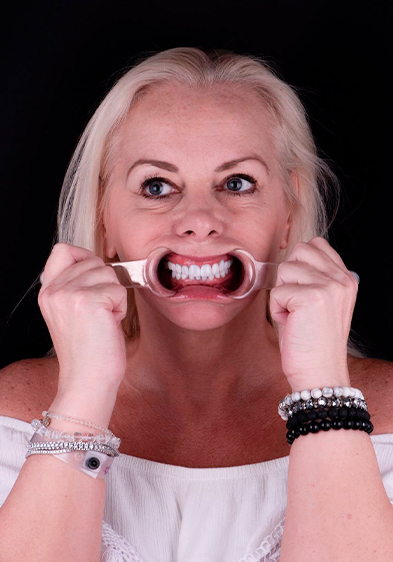 middle age woman showing her new teetg after getting full mouth dental implants in Mexico
