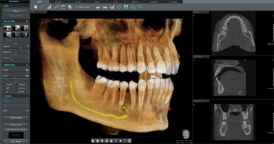3d dentistry prime software