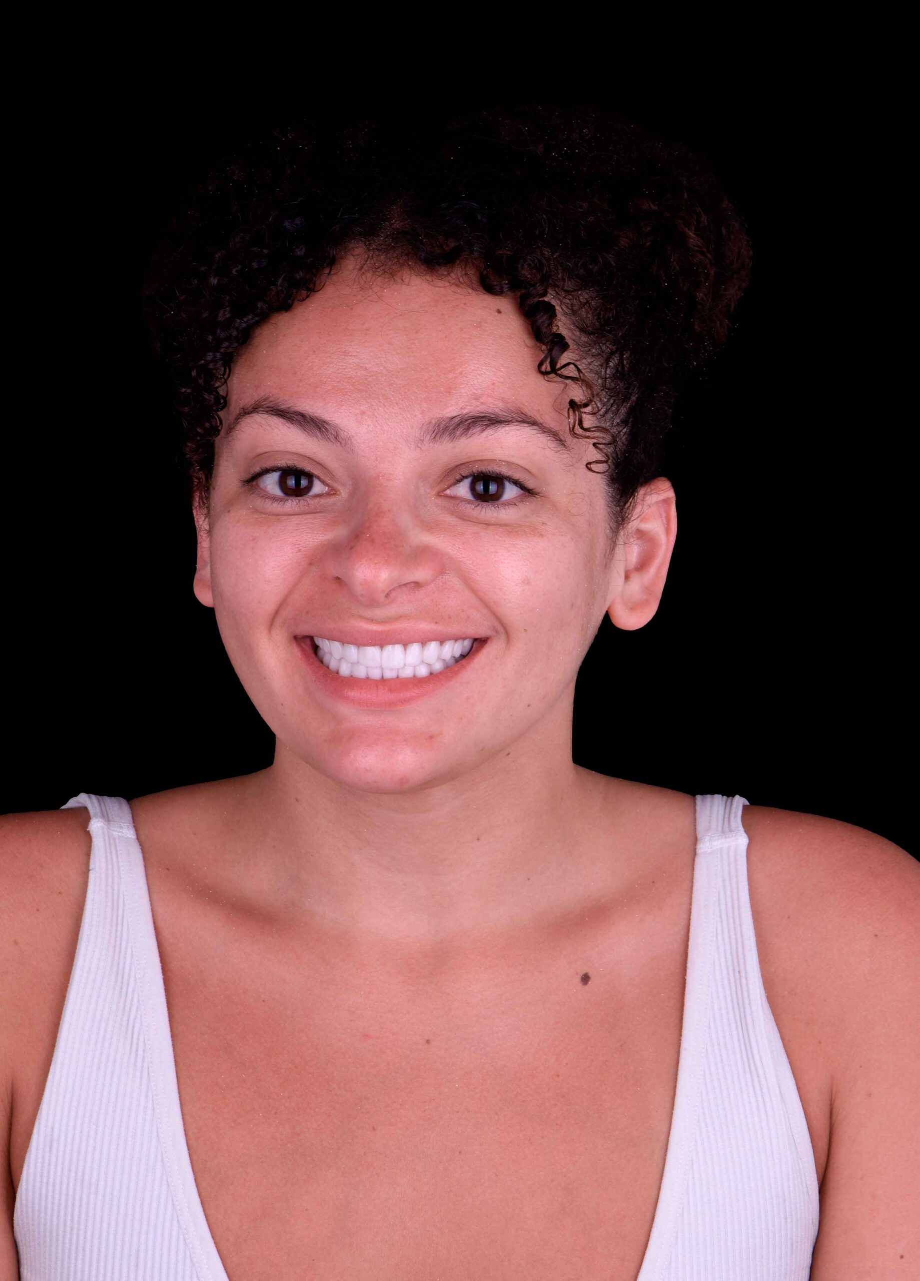 young woman with a full mouth of zirconia dental crowns