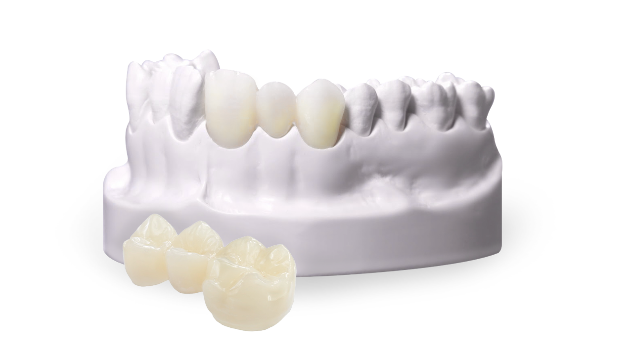 porcelain dental crowns in Mexico 