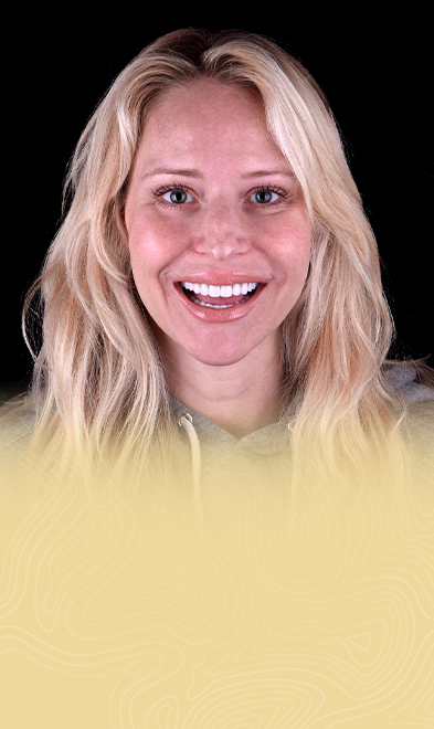 Young woman smiling after getting veneers in Cancun