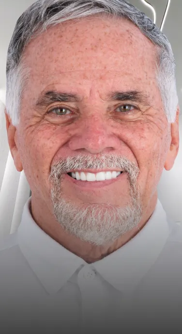 Close-up image of a complete smile restored with All-on-4 dental implants. Prime Advanced Dentistry in Cancun offers All-on-4 treatment packages.