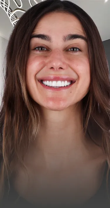 Close-up image of a dental crown placed on a female patient. Prime Advanced Dentistry in Cancun offers dental crown packages.