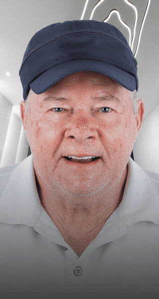 Fixed and natural smile with snap-on-denture at Prime Advanced Dentistry at Cancun Mexico