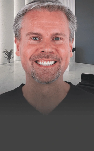 Snap on Dentures with mini implant, the perfect choice for patients with low bone density at Prime Dental Clinic Cancun