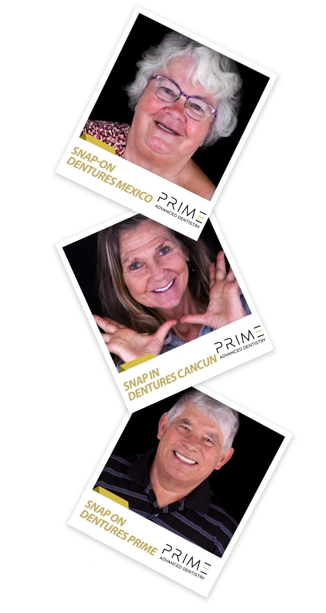 Amazing patients results after dental treatment in Mexico by Cancun Dentists