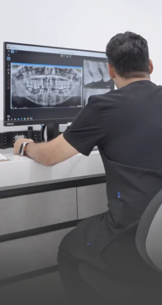 personalized teeth procedures with digital dentistry in cancun, mexico