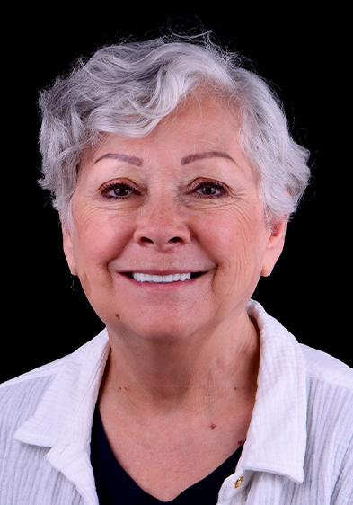 Elder woman snap-on dentures before and after