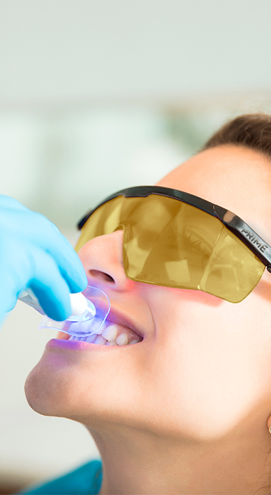 types and process of teeth whitening at prime advanced dentistry