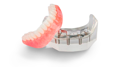 cost of bar-retained snap-on dentures in Mexico