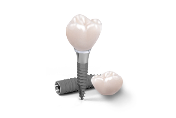 Straumann Titanium dental implants in Mexico