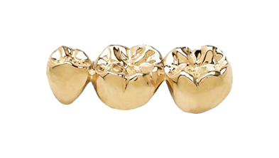 cost of yellow gold dental crowns in Mexico