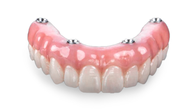 cost of all on 4 zirconia denture in Mexico