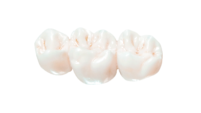 cost of zirconia dental crowns in Mexico