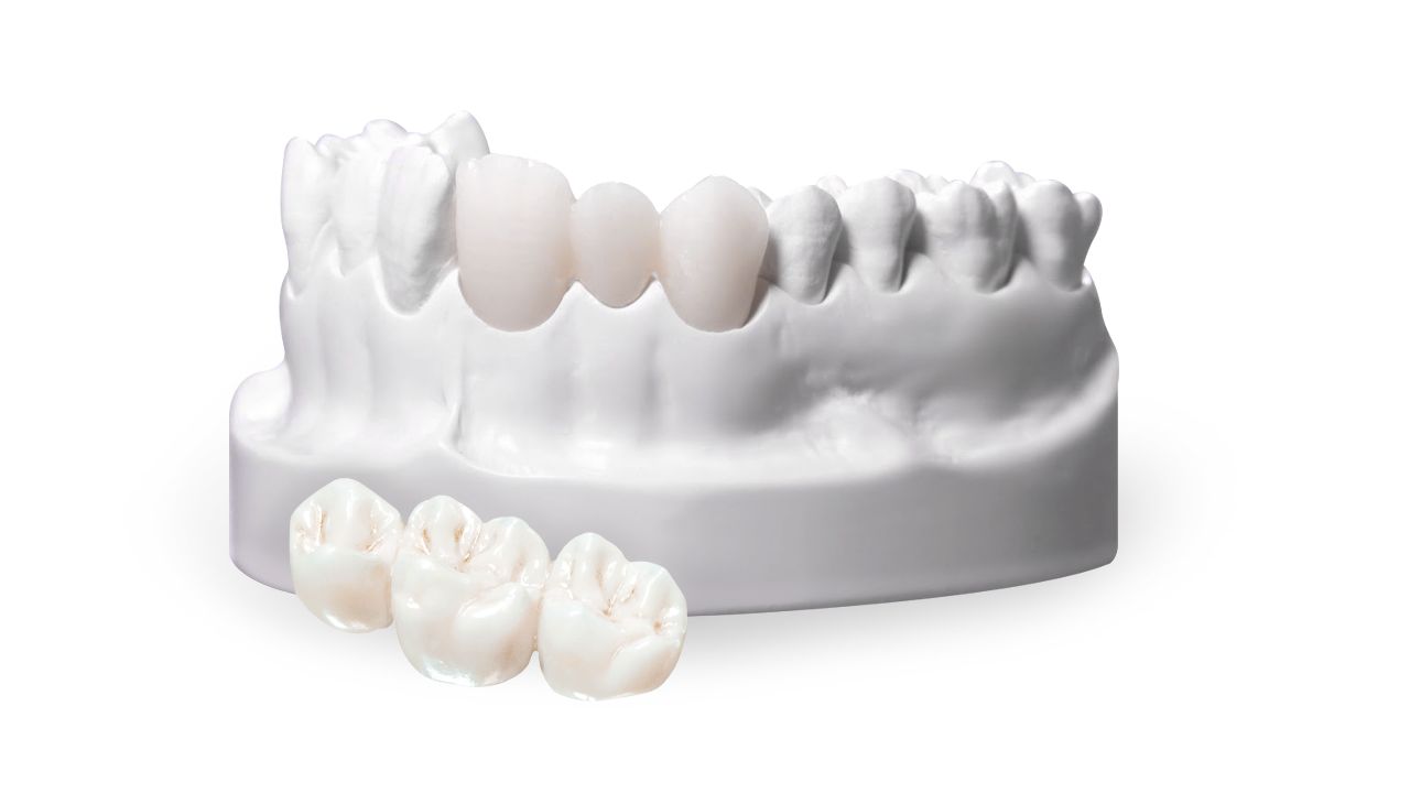 zirconia dental crowns in Mexico 