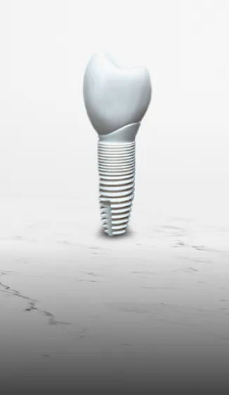 Illustration of zirconia dental implants, emphasizing their natural appearance and metal-free composition